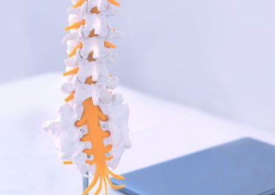 Anatomical model of the lumbar spine showing nerve roots exiting in the lumbosacral region.